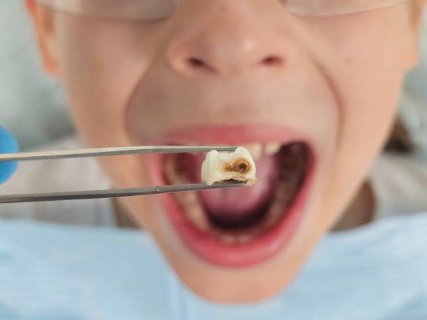 Best Broken Tooth Emergency  in Energy, IL