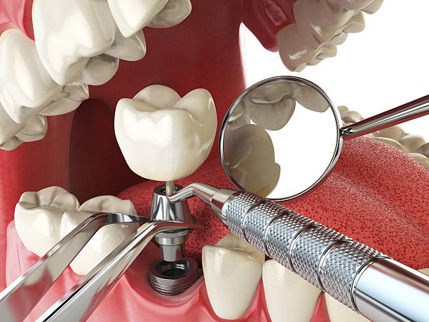 Best Dentist for Tooth Abscess  in Energy, IL